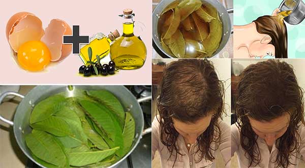 This particular remedy stopped her baldness saved her from baldness