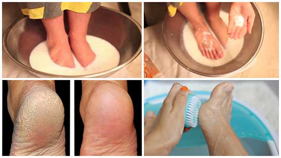 Use these 2 ingredients through the kitchen to get soft good-looking feet