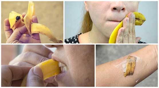 Magical beauty purposes of Banana peels that may stop you from throwing it away