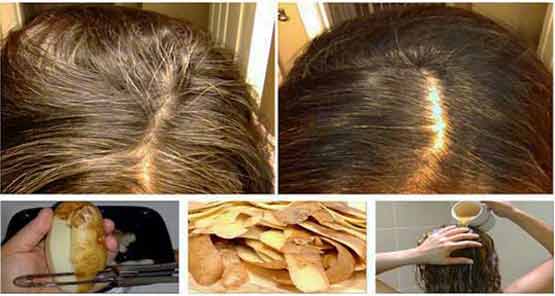 This would not remove your white hairs, but cause them to become naturally black