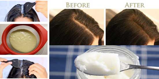 This makes your own hair thick and black within one use, you are going to love your shiny hair