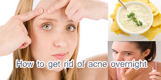 Magical remedy to remove oily and dirty skin in mere recognized